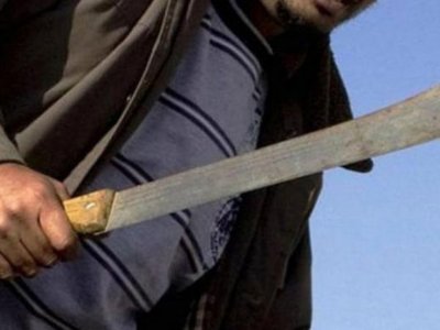 Con machete le cortaron las manos en la frontera