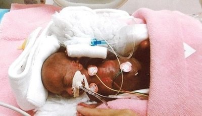 El bebé más chico ya irá a su casa