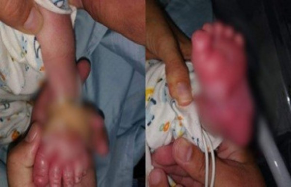 Denuncian que un bebé es nueva víctima de negligencia médica - Radio 1000 AM