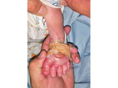 Papá de bebé denuncia negligencia en  Hospital distrital de San Ignacio