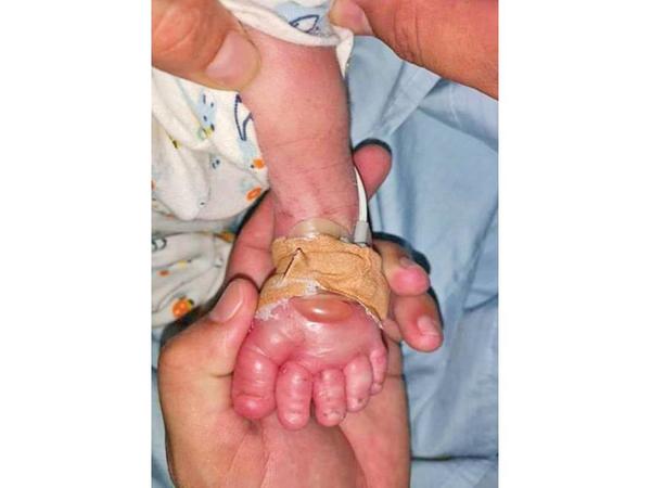 Papá de bebé denuncia negligencia en Hospital distrital de San Ignacio