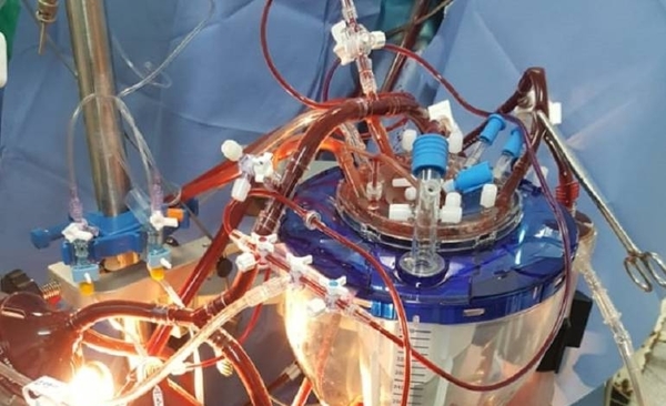 HOY / Primera cirugía de aorta con técnica mini invasiva: paciente cardiaca con buena evolución