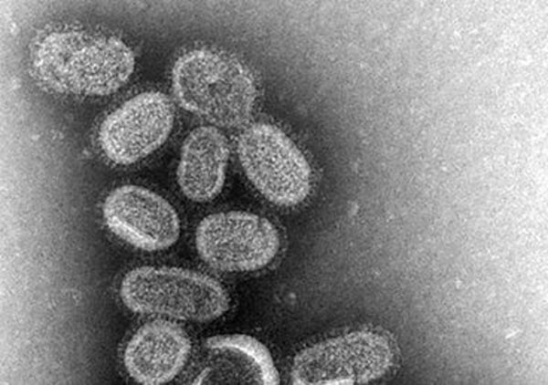 Científicos identifican cerca de 200.000 especies de virus marinos - Ciencia - ABC Color