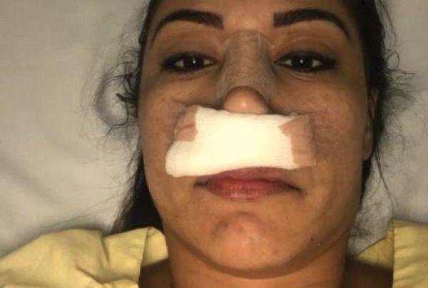 â€œYo fui la agredida, me rompió mi nariz y me pateó frente a mí­ hijaâ€ | Paraguay en Noticias 