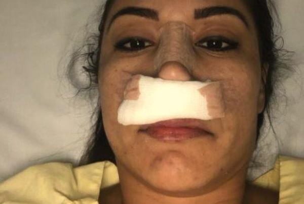 “Yo fui la agredida, me rompió mi nariz y me pateó frente a mí hija†| Paraguay en Noticias