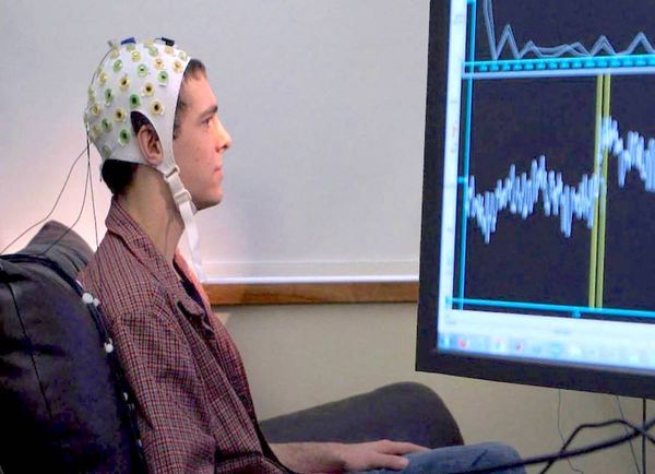 Cuando un implante cerebral transforma