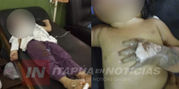 NIÑAS QUEMADAS NECESITAN AYUDA SOLIDARIA.