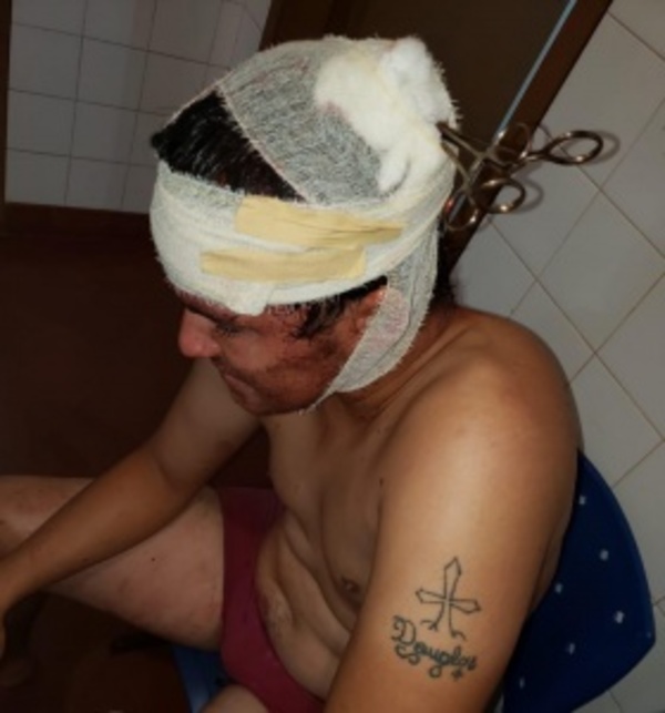 Malviviente resultó brutalmente herido en un asalto domiciliario - ADN Paraguayo