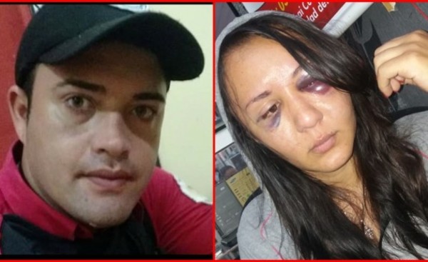 Mujer fue golpeada brutalmente por su pareja