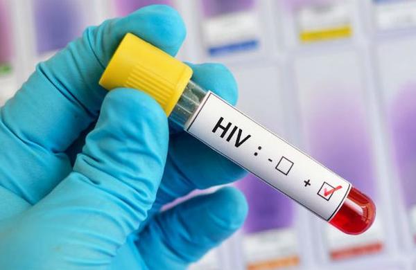 Estudio descubre que ciertos medicamentos detienen la transmisión del VIH - C9N