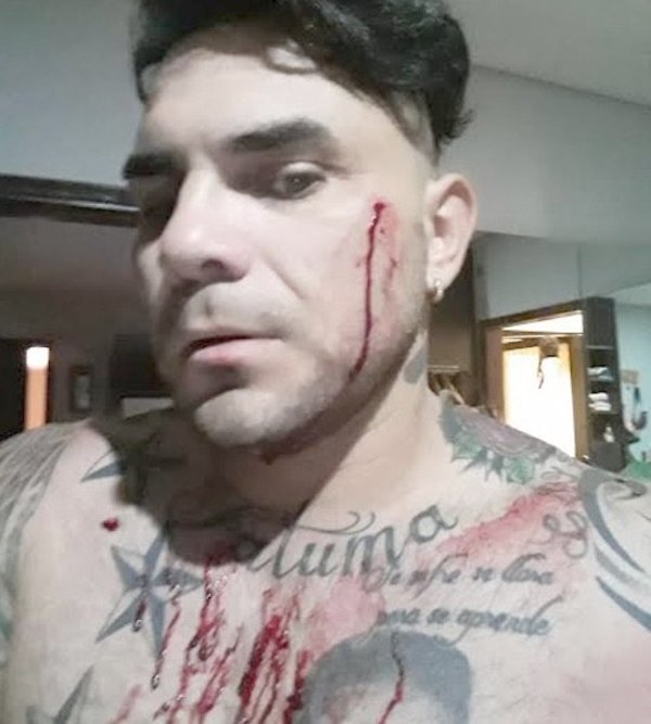 Pelotero denunció que su esposa le acuchilló