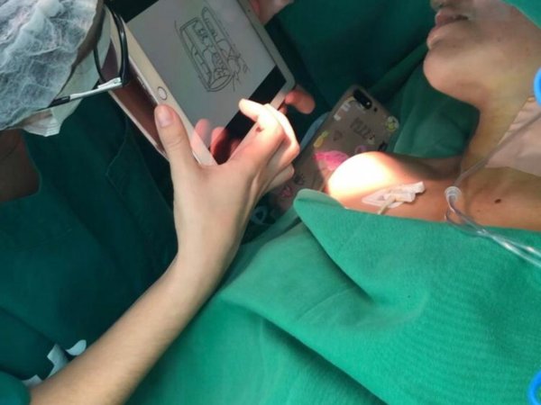 Inédita cirugía neurocerebral con paciente despierta duró seis horas