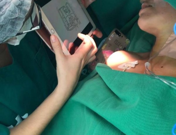 Extirpan tumor cerebral a un paciente despierto por primera vez en el país » Ñanduti