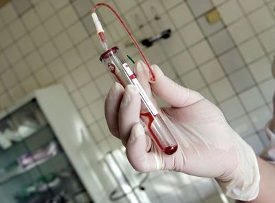 Científicos desarrollan tecnología para detectar bacterias en minutos