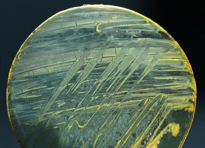 Científicos desarrollan tecnología para detectar bacterias en minutos - Ciencia - ABC Color