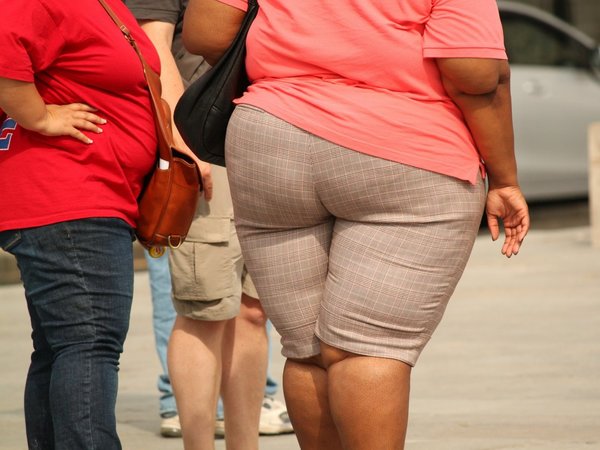 Revelan que aumento de la obesidad global proviene más del mundo rural