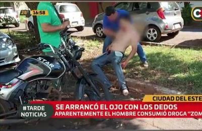 Un hombre se arrancó un ojo con sus dedos en Ciudad del Este - C9N