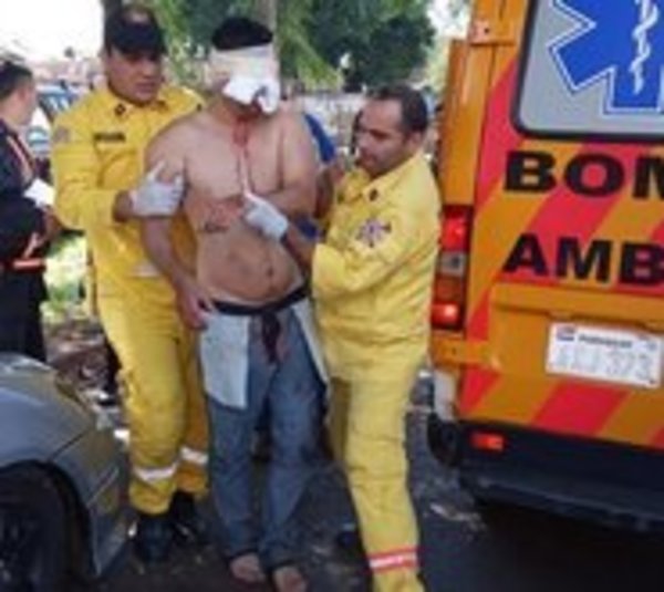 Hombre se arranca un ojo y se explota el otro en Ciudad del Este - Paraguay.com