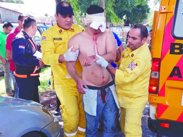 Fue por drama amoroso que el brasileño se arrancó el ojo
