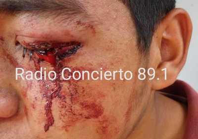 Hombre golpea brutalmente a su hijo