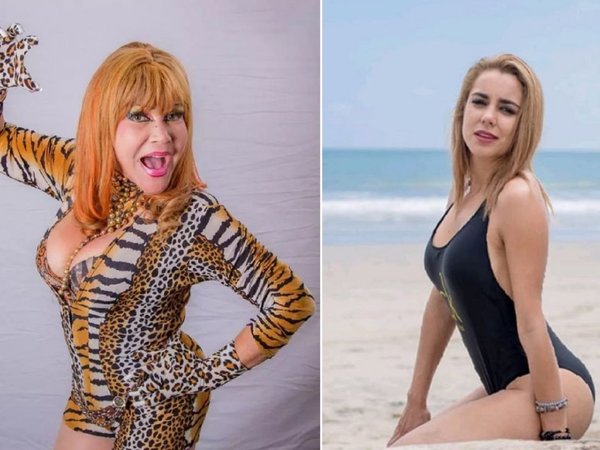 La Tigresa se sometió a una "chuchuplastía"