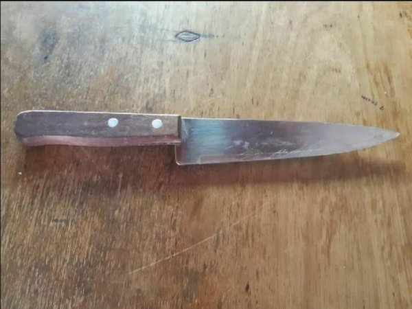 Pescó por su expareja y la apuñaló en el brazo