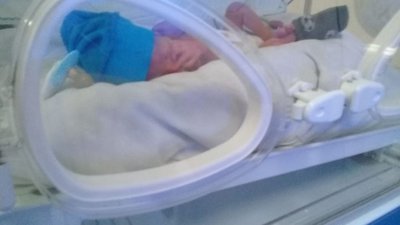 Bebé necesita terapia intensiva con urgencia - Nacionales - ABC Color