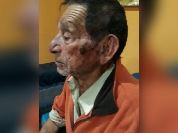 Golpean brutalmente a anciano de 89 años para robarle G. 2 millones