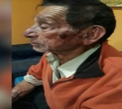 Malvivientes agreden brutalmente a abuelo para robarle G. 2 millones - Paraguay.com