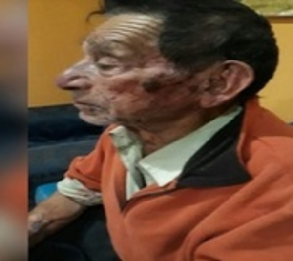 Malvivientes agreden brutalmente a abuelo para robarle G. 2 millones - Paraguay.com