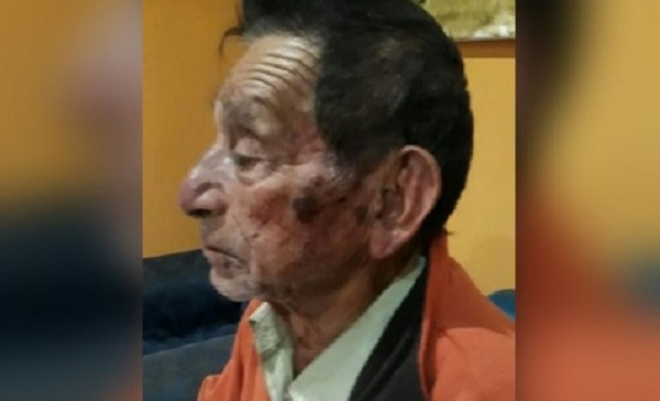 Golpean y roban G. 2 millones a adulto mayor