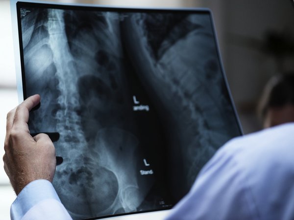 Sistema de inteligencia artificial para detectar cáncer de pulmón