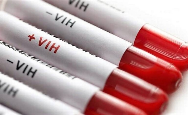 HOY / Divulgan lista de empresas denunciadas por despedir a empleados que viven con VIH