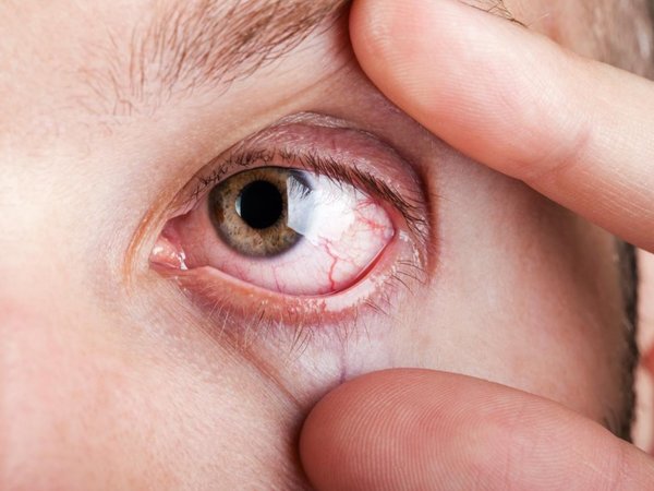 El 60% de los diabéticos presentan retinopatías tras diagnóstico