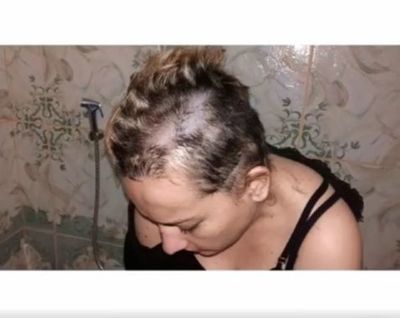 Pareja se acusa mutuamente de violencia - Nacionales - ABC Color