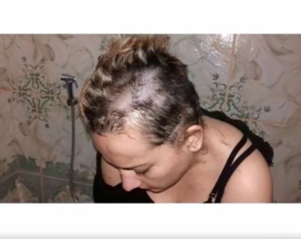 Pareja se acusa mutuamente de violencia - Nacionales - ABC Color