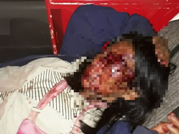 Borracho golpeó brutalmente a su doña