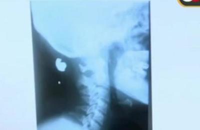 Entregan novedades sobre el estado de salud de la embarazada baleada - C9N