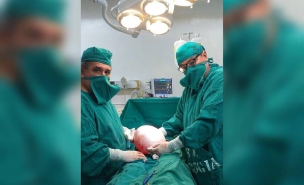 HOY / Extirpan tumor ovárico de seis kilos de paciente del Regional de Oviedo