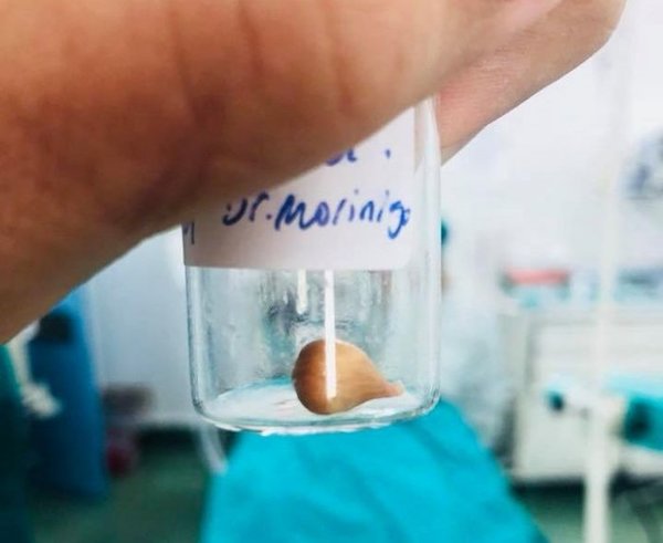 Niño en terapia por semilla de mandarina - Nacionales - ABC Color