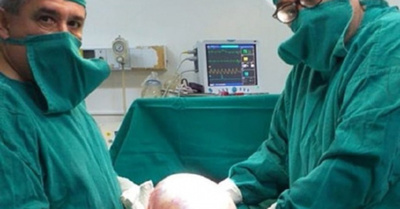 Extirparon con éxito un tumor de 6 kilos voi