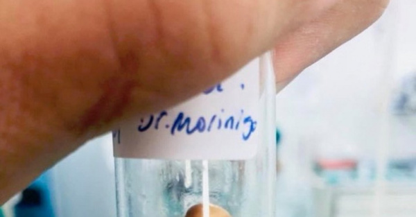 Semilla de mandarina casi asfixia a un niño