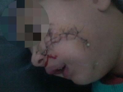 Perro desfigura cara de una criatura
