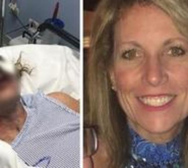 Agreden a mujer en hotel lujoso de Punta Cana - Paraguay.com