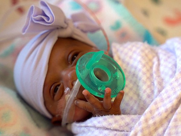 La bebé prematura más pequeña del mundo sale del hospital en California