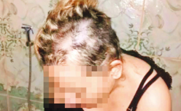 Dejan desamparada a víctima de violencia | Diario Vanguardia 08