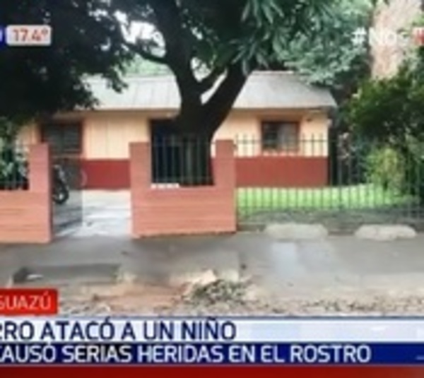 Caaguazú: Perro ataca a niño y lo hiere gravemente en el rostro - Paraguay.com