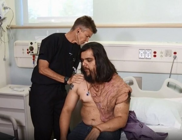Cirujanos de EE.UU. operarán a paraguayo del mal de 'hombre elefante' - Radio 1000 AM