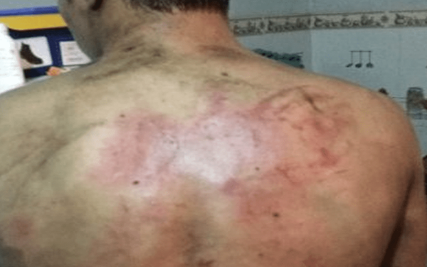 CAAZAPÁ: IMPUTAN A ESTUDIANTES POR BRUTAL “BAUTISMO”