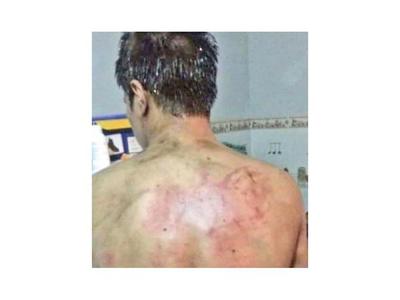 Imputan a 4 estudiantes por lesión grave tras bautismo
